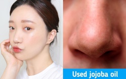 7 cách khiến lỗ chân lông từ to hóa nhỏ, da dẻ mướt căng và bóng mịn thấy rõ
