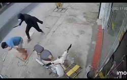 Đang đi bộ, bị kẻ bịt mặt chém lìa chân