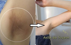 Bí quyết nhanh gọn trị thâm vùng nách của beauty blogger