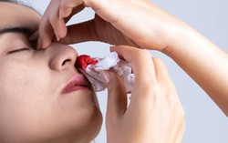 4 chỗ chảy máu bất thường, rất có thể là ung thư giai đoạn cuối
