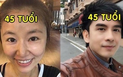 Tại sao phụ nữ già nhanh hơn nam giới?