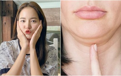 4 thói quen khiến cằm nọng, da chảy xệ mà chị em cứ vô tư làm hàng ngày