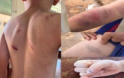 Kịp thời phát hiện nguy cơ bị bạo hành đối với trẻ em có cha mẹ ly hôn