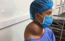 Khối u khổng lồ ở cổ bệnh nhân 23 tuổi