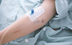 Sốc phản vệ nặng do truyền dịch tại nhà