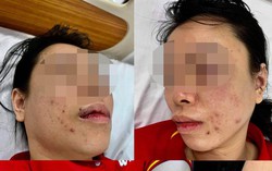 Người phụ nữ tố bị chồng cũ "bắt cóc" đánh đập dã man: Hội LHPN quận Bắc Từ Liêm đề nghị xử lý nghiêm