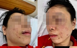 Tạm giữ người đàn ông "bắt cóc" đánh đập vợ cũ gần 1 ngày