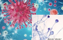 Nhiều người nhiễm nấm đen Mucormycosis, bệnh này nguy hiểm như thế nào?