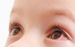 Đâu là con đường lây truyền Adenovirus phổ biến nhất?
