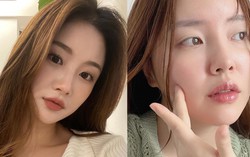 6 cách ngăn ngừa mụn trong dịp Tết