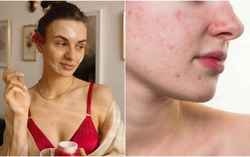 Chuyên gia cảnh báo 4 bước chăm sóc da dễ khiến da kích ứng