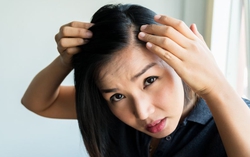 6 bất thường ở vùng đầu và mặt đang "tố cáo" bệnh gan