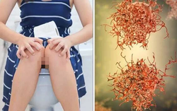 1 dấu hiệu trong kỳ kinh nguyệt cảnh báo bệnh ung thư