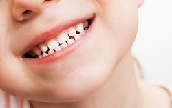 Cách khắc phục tình trạng răng trẻ bị đen khi uống sắt nước