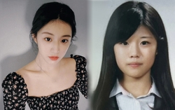 Netizen bênh vực Go Yoon Jung trước cáo buộc thẩm mỹ cả mặt