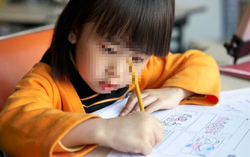 Loạn thị và những biến chứng ở trẻ
