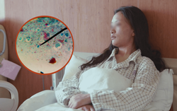 Cô gái 21 tuổi bị sán bám "đặc" gan, nguyên nhân từ 2 thói quen nhiều người mắc