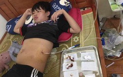 Hoàn cảnh đáng thương của nam sinh lớp 9 xin ra viện về nhà tự chạy thận