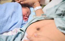 4 nguyên nhân khiến các mẹ đẻ mổ lần 2 có cảm giác đau đớn hơn lần đầu