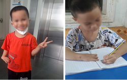 “Phép màu” đến với những bệnh nhi có đôi tay bị di tật