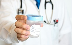 Vì sao tinh dịch lại có màu vàng?