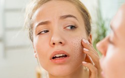 Cách phân biệt và giải pháp khắc phục tình trạng da khô và da bị mất nước