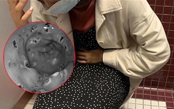 Xem nhẹ 1 bất thường khi đại tiện, lúc nội soi mới “tá hỏa” vì có tới 30 vết loét trong dạ dày