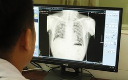 Vụ 6 người tử vong do bụi phổi ở Nghệ An: Phát hiện thêm 57 người mắc bệnh