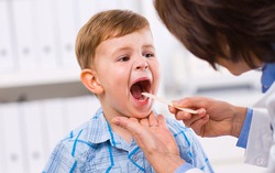 Viêm VA có lây không? Phòng ngừa viêm VA bằng cách nào?