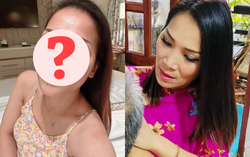 Nữ ca sĩ Vbiz thay đổi dung mạo ngỡ ngàng sau sự cố bỏng nặng 