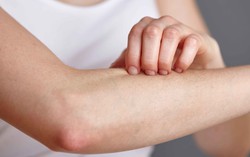 Các bệnh da liễu dễ mắc phải khi thời tiết nồm ẩm