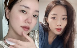 4 sản phẩm chăm sóc da bác sĩ khuyên các chị em nên ít dùng 