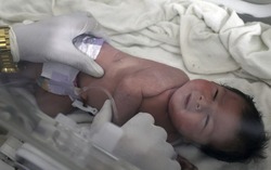Bé gái Syria chào đời trong đống đổ nát của tòa nhà bị sập, dây rốn vẫn nối với bánh nhau trong bụng mẹ