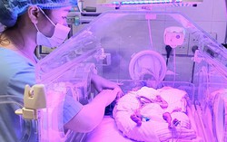 3 tháng diệu kỳ với bé gái sinh non ở tuần 24, nặng vỏn vẹn 700g