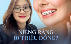 Cơn sốt "Niềng răng từ A đến Z giá rẻ dưới 10 triệu đồng", bác sĩ cảnh báo 