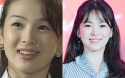 Song Hye Kyo, Lâm Tâm Như thăng hạng nhan sắc nhờ niềng răng