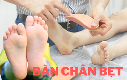4 việc cha mẹ cần làm để giảm nguy cơ con bị bàn chân bẹt