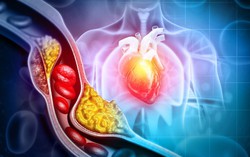 Sắp có thuốc làm giảm 60% mức cholesterol “xấu” trong 8 tuần