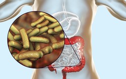 Cảnh báo bệnh lý do vi khuẩn Shigella: Những điều cần biết để bảo vệ sức khoẻ