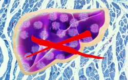 Phát hiện loại virus mới gây bệnh viêm gan ở một bệnh nhân nữ