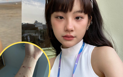 Hot girl người Tày Ceri Thu Hà lần đầu nói về các vết thương chằng chịt trên cánh tay