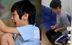 Nam thiếu niên bị Tic hỗn hợp đến suy kiệt sức khỏe