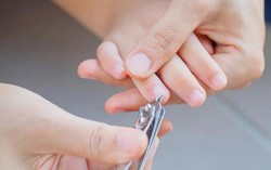 Kiểu cắt móng tay trông gọn gàng nhưng có thể gây mưng mủ, nhiễm trùng huyết