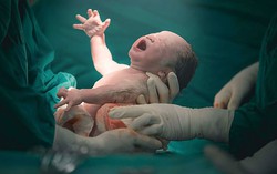 Mẹ bầu đẻ thường được nhưng sợ đau nên muốn đẻ mổ có được không?