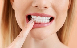4 sai lầm thường gặp trong mùa hè dễ làm hỏng men răng