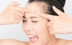 11 nguyên nhân gây mụn trứng cá, số 10 rất nhiều người mắc phải