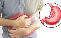15 tuổi thủng dạ dày: Bác sĩ điểm danh "thủ phạm", chỉ cách phòng ngừa