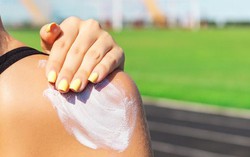 Cần làm gì khi dị ứng kem chống nắng gây ngứa?