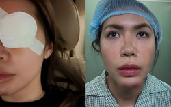 Minh Tú tiếp tục gặp vấn đề sức khỏe sau sự cố phải khâu 10 mũi ở cằm