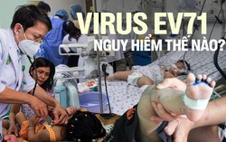 Virus gây bệnh tay chân miệng đã trở lại: EV71 nguy hiểm thế nào?